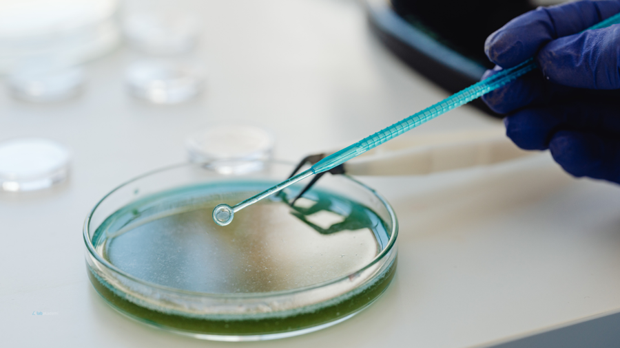 Kozmetik Mikrobiyolojisinde Mantar Kontaminasyonu: ISO 16212 Standartı ve Analiz Teknikleri